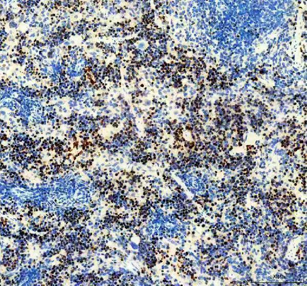 IHC analysis of Ki67/MKI67 using anti-Ki67/MKI67 antibody (M00254-11)