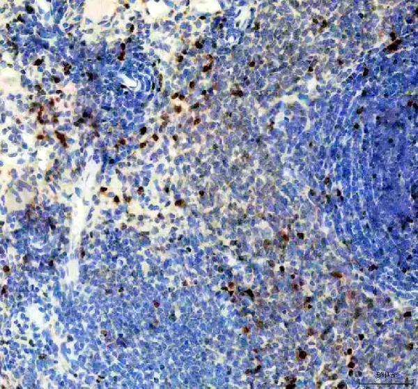 m00254 11 ki67 primary antibodies ihc testing 3