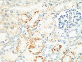 m00254 7 mki67 primary antibodyes ihc testing 1