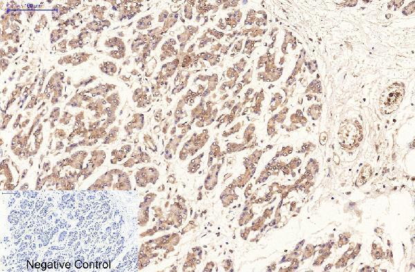 m00254 7 mki67 primary antibodyes ihc testing 2