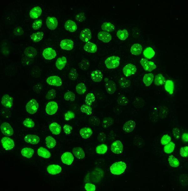 m00254 9 ki67 primary antibodies if testing 7