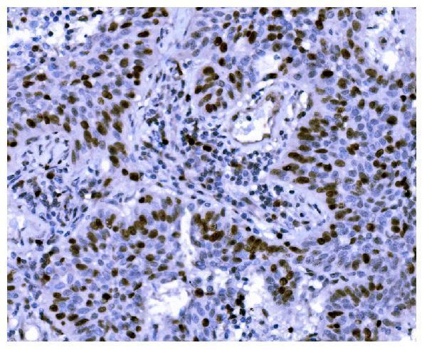  IHC analysis of Ki67 using anti-Ki67 antibody (M00254-9)