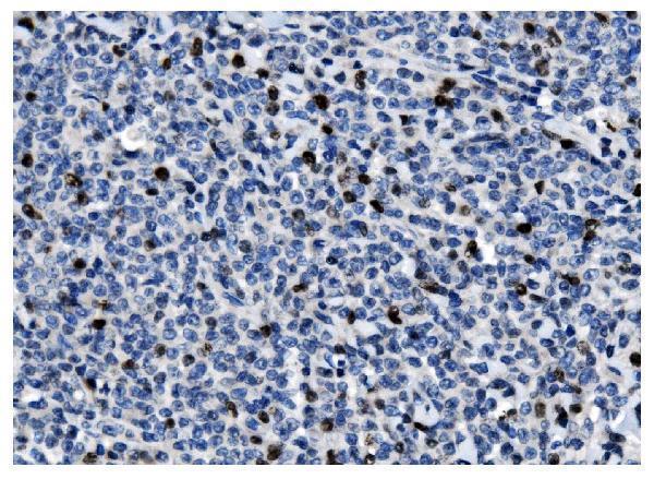 m00254 9 ki67 primary antibodies ihc testing 3
