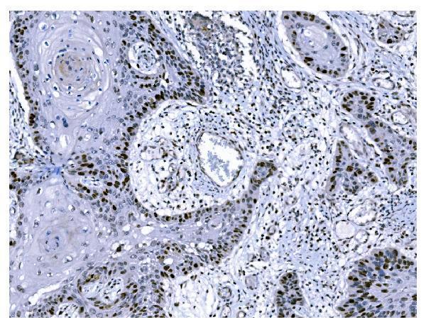 m00254 9 ki67 primary antibodies ihc testing 5