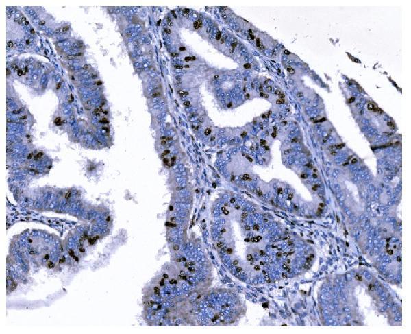 m00254 9 ki67 primary antibodies ihc testing 6