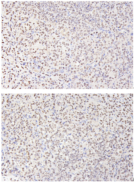m00254 9 ki67 primary antibodies ihc testing 7