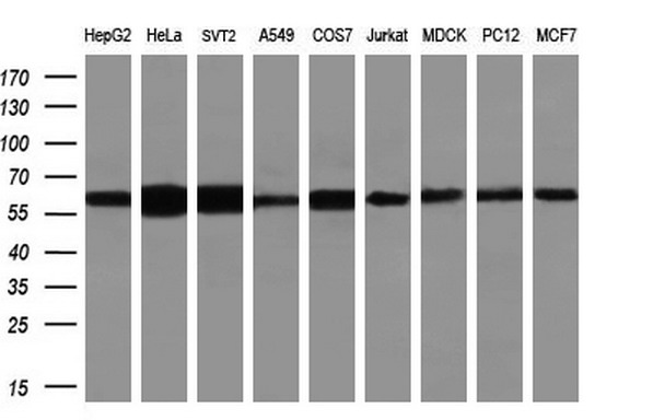Western blot analysis of extracts (10ug) from 9 different cell lines by using anti-HDAC1 monoclonal antibody (HepG2: human; HeLa: human; SVT2: mouse; A549: human; COS7: monkey; Jurkat: human; MDCK: canine; PC12: rat; MCF7: human) (1:1000)