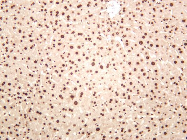 Mouse liver was stained with anti-HDAC1 rabbit antibody