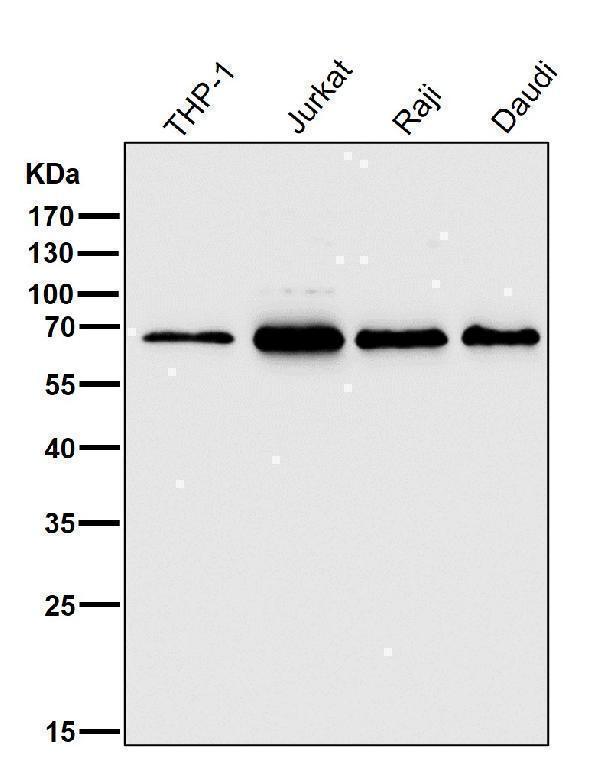 All lanes use the Antibody at 1:1K dilution for 1 hour at room temperature