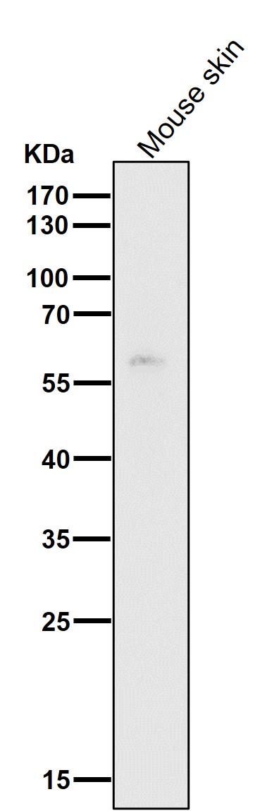 All lanes use the Antibody at 1:1K dilution for 1 hour at room temperature