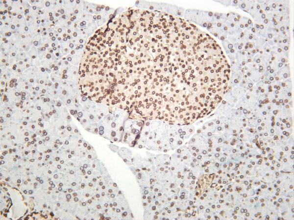 m00257 1 e2f1 primary antibodies ihc testing 1