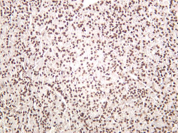 m00257 1 e2f1 primary antibodies ihc testing 2