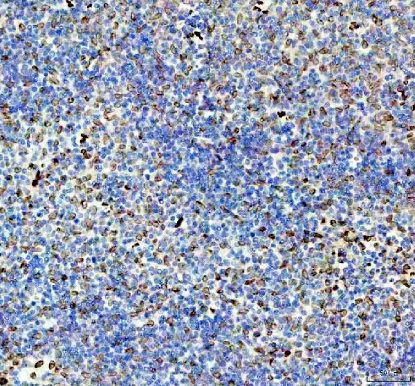 m00257 e2f1 primary antibodies ihc testing 1