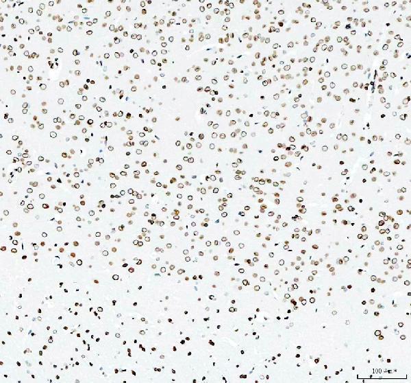 m00257 e2f1 primary antibodies ihc testing 10