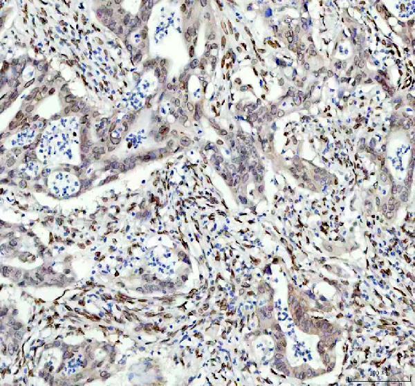 m00257 e2f1 primary antibodies ihc testing 2