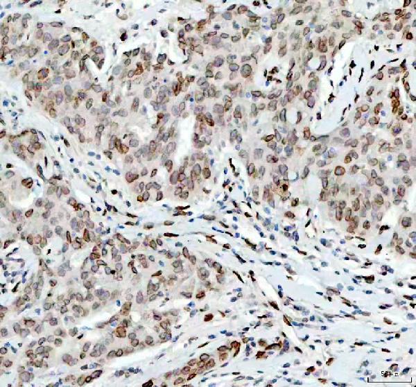 m00257 e2f1 primary antibodies ihc testing 3