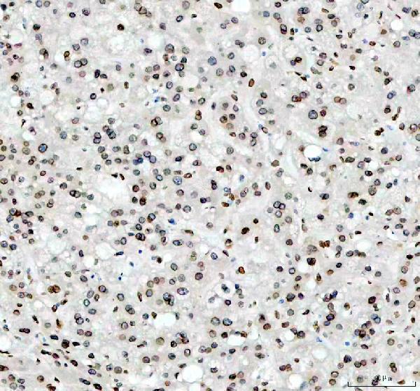 m00257 e2f1 primary antibodies ihc testing 4