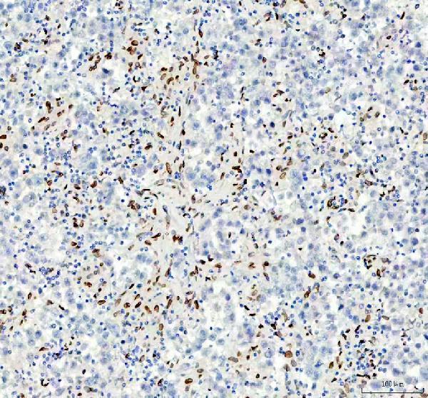 m00257 e2f1 primary antibodies ihc testing 7