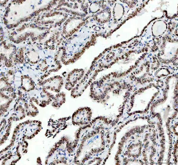 m00257 e2f1 primary antibodies ihc testing 8