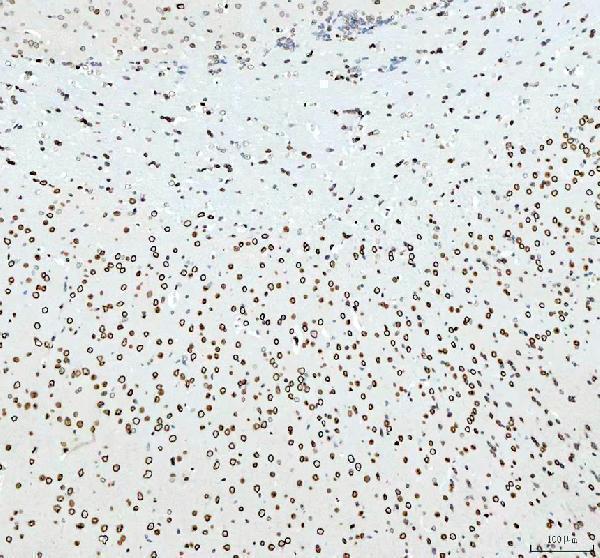 m00257 e2f1 primary antibodies ihc testing 9
