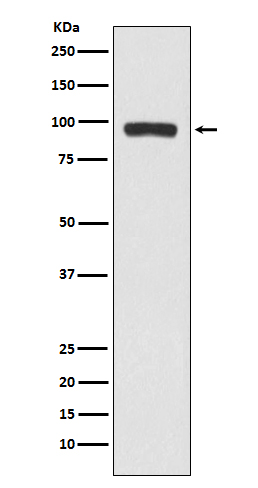 Western blot analysis of BCHE expression in A375 cell lysate