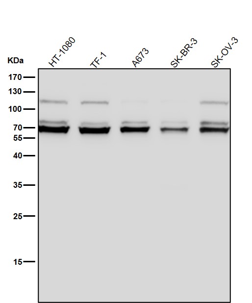 All lanes use the Antibody at 1:2W dilution for 1 hour at room temperature