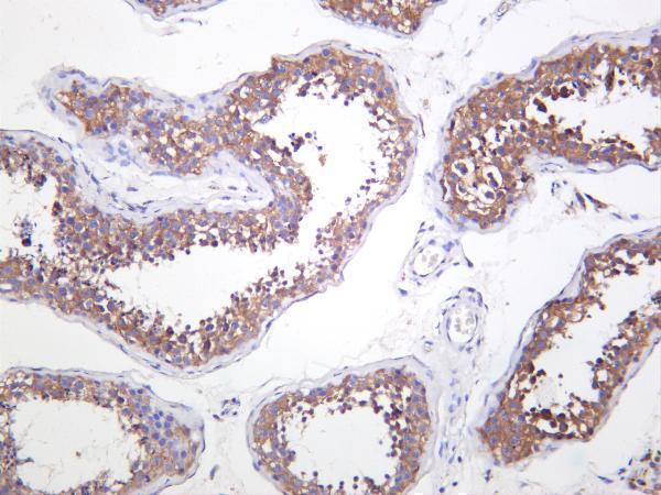 Human testis was stained with anti-TBK1 rabbit antibody
