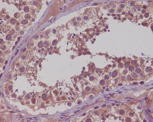 m00261 ihc