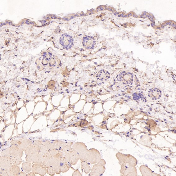 m00261 ihc11