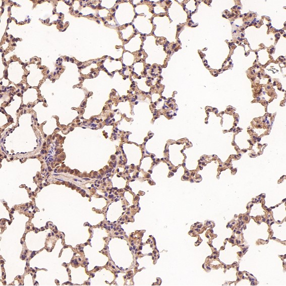 Immunohistochemical analysis of paraffin-embedded Rat liver, using the Antibody at 1:50 dilution
