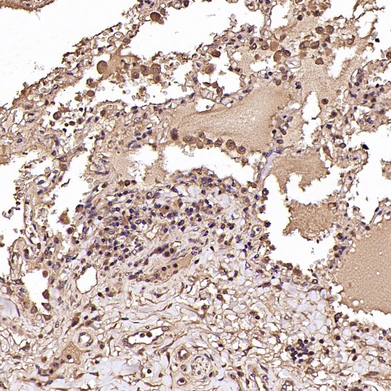 m00261 ihc9