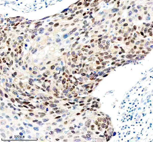  IHC analysis of FOXA1 using anti-FOXA1 antibody (M00266-1)