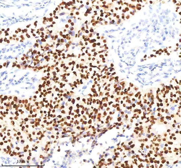  IHC analysis of FOXA1 using anti-FOXA1 antibody (M00266-1)