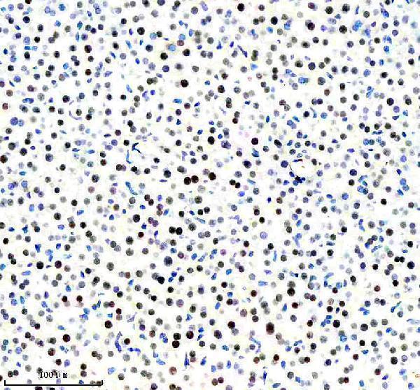 m00266 1 foxa1 primary antibodies ihc testing 4