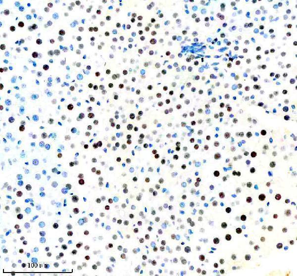 m00266 1 foxa1 primary antibodies ihc testing 5