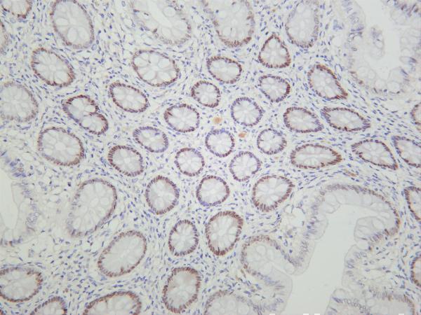 m00266 4 foxa1 primary antibodies ihc testing 4