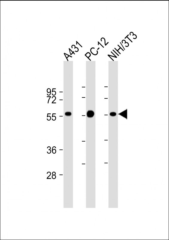 All lanes : Anti-MITF Antibody at 1:2000 dilutionLane 1: A431 whole cell lysateLane 2: PC-12 whole cell lysateLane 3: NIH/3T3 whole cell lysateLysates/proteins at 20 µg per lane