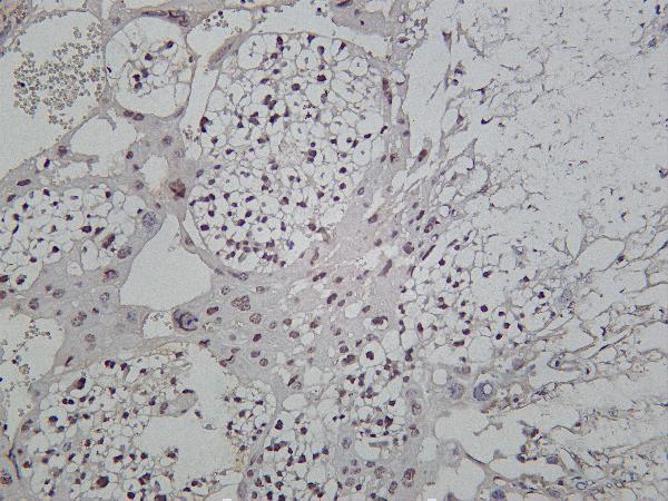 Mouse placenta was stained with Anti-MiTF rabbit antibody