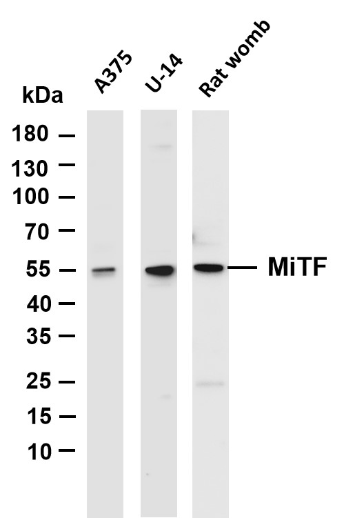 Various whole cell lysates were separated by 4-20% SDS-PAGE, and the membrane was blotted with anti-MiTF antibody