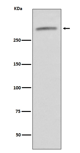 Western blot analysis of VWF expression in human serum lysate