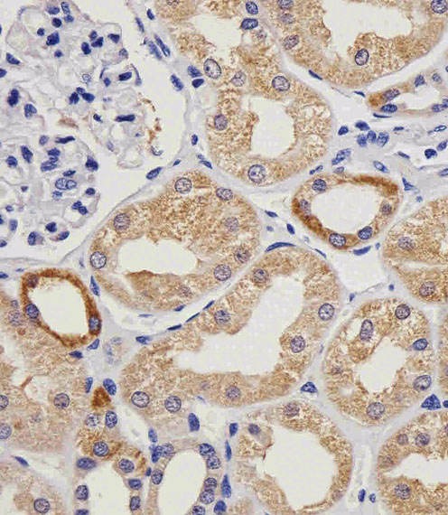 Immunohistochemical analysis of paraffin-embedded H