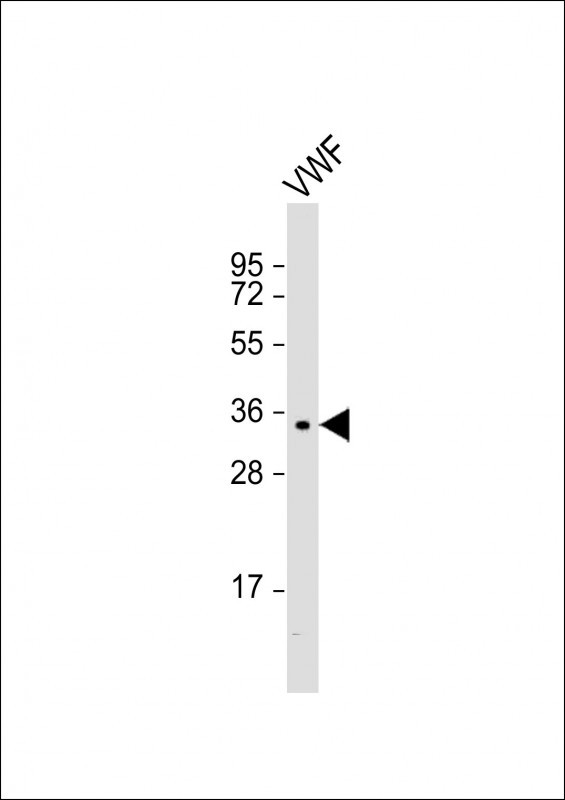 Anti-VWF at dilution + VWF whole cell lysateLysates/proteins at 20 µg per lane