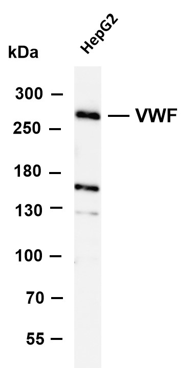Various whole cell lysates were separated by 4-8% SDS-PAGE, and the membrane was blotted with anti- VWF antibody