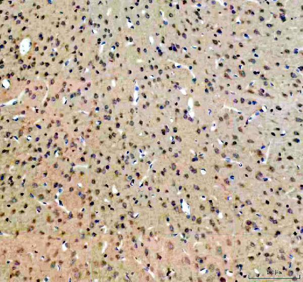 m00273 3 pax6 primary antibodies ihc testing 2