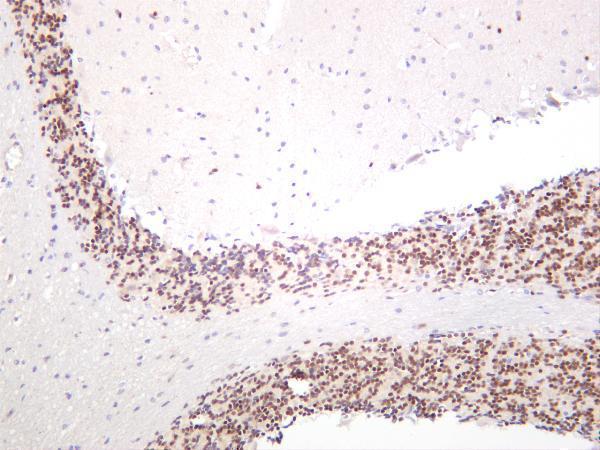 m00273 5 pax6 primary antibodies ihc testing 1