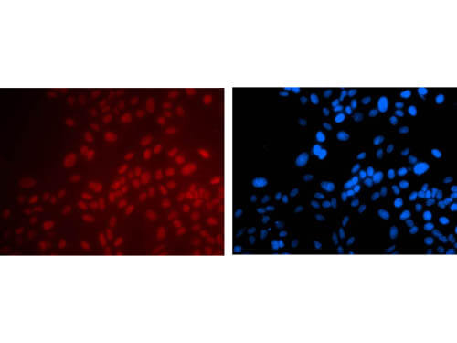 m00273 pax6 primary antibodies if testing 1