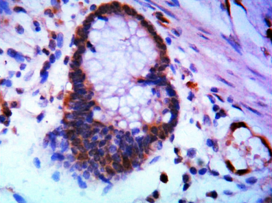 Immunohistochemistry validation of SOCS3 using Anti-SOCS-3 Monoclonal Antibody (M00274-1)