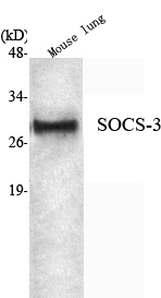 Western blotting validation for Anti-SOCS-3 Monoclonal Antibody M00274-1
Western Blot (WB) analysis using SOCS-3 Monoclonal Antibody against Mouse Lung lysate