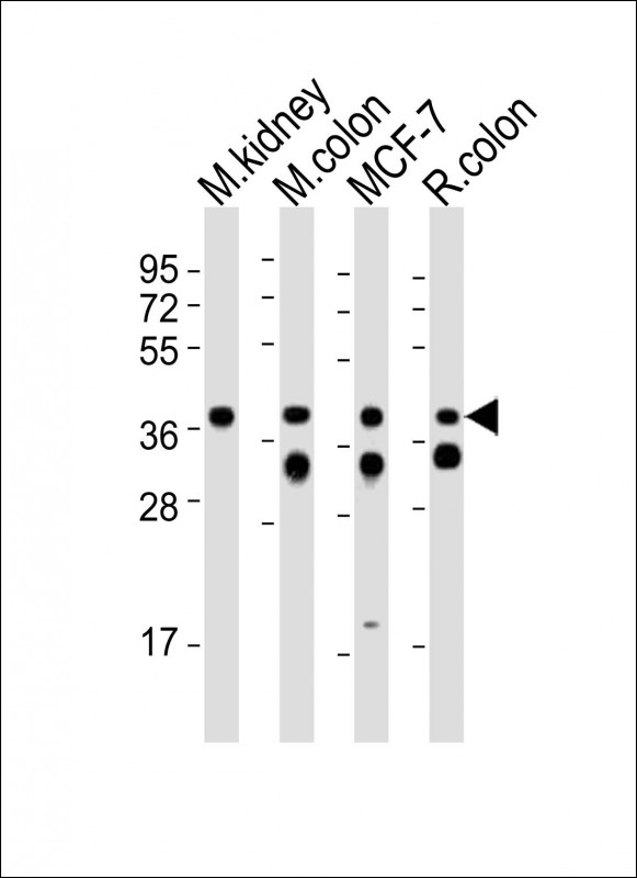 All lanes : Anti-Epcam Antibody (C-term) at 1:2000 dilutionLane 1: mouse kidney lysatesLane 2: mouse colon lysatesLane 3: MCF-7 whole cell lysatesLane 4: rat colon lysatesLysates/proteins at 20 µg per lane