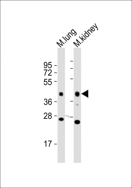 All lanes : Anti-Epcam Antibody (C-term) at 1:2000 dilutionLane 1: mouse lung lysatesLane 2: mouse kidney lysatesLysates/proteins at 20 µg per lane